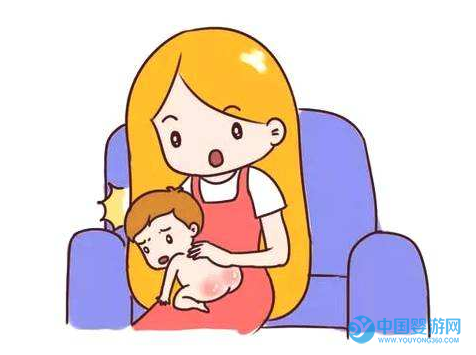 寶寶出現(xiàn)紅屁股破皮怎么辦2