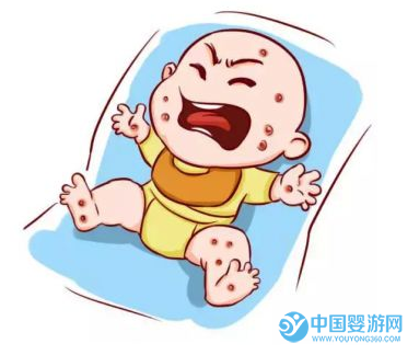 寶寶濕疹的原因及護理方法4