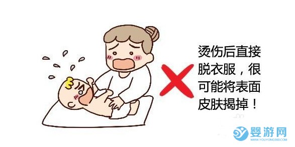 寶寶燙傷五步急救法!家長要知道! 寶寶燙傷怎么辦 寶寶燙傷的急救方法 寶寶燙傷五步急救法