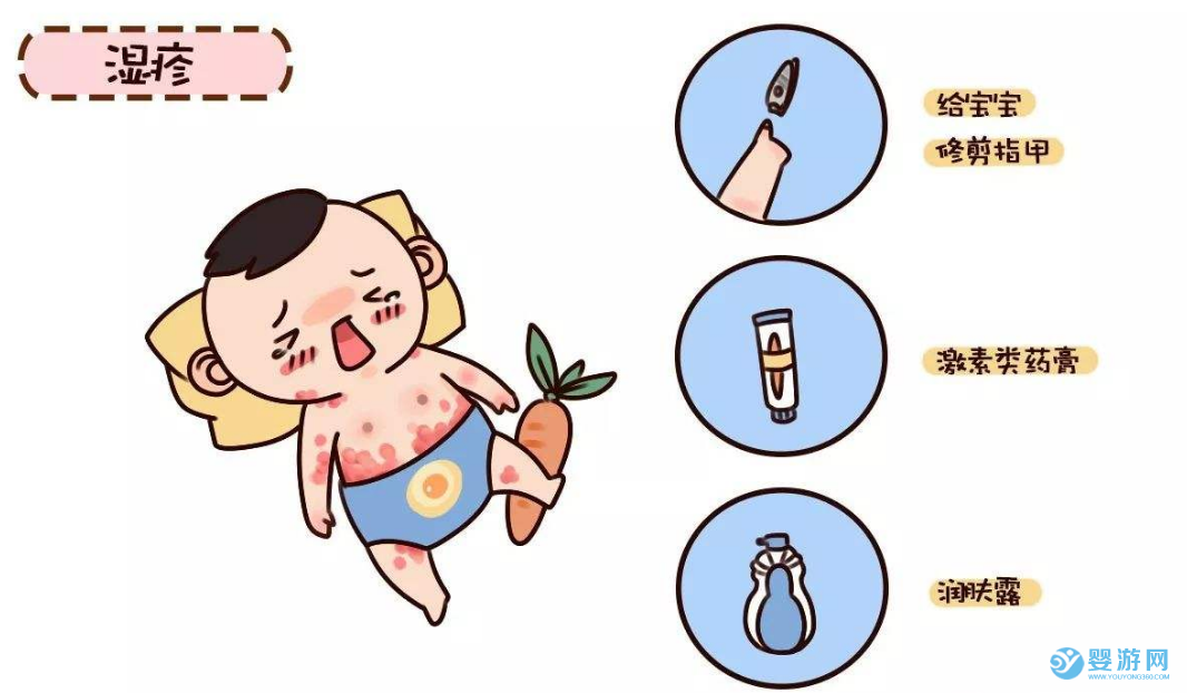 五種常見的新生兒疾病及預防方法 寶寶常見疾病及預防 新生兒黃疸怎么辦 新生兒常見疾病及預防 預防新生兒常見疾病