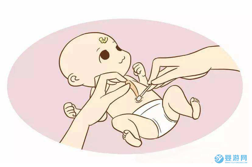 嬰兒的臍帶護理、臍部護理注意事項